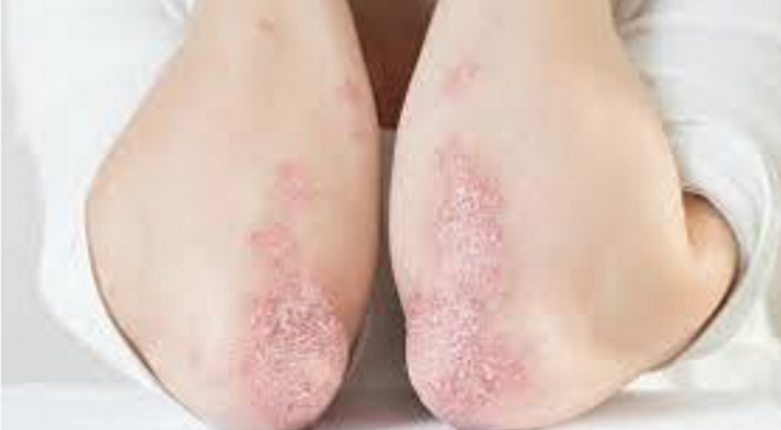 <p>Describe this lesion</p>