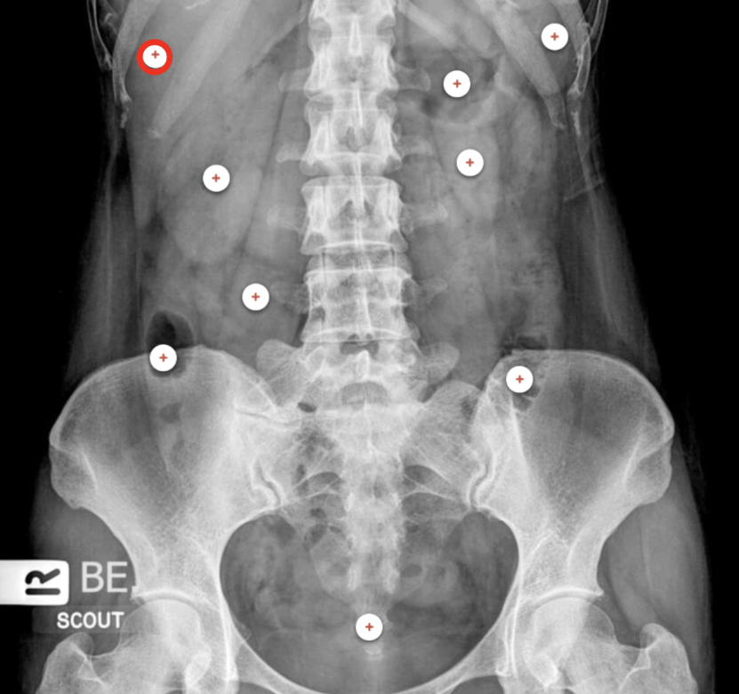 <p>what structure is the red circle labeling? </p>