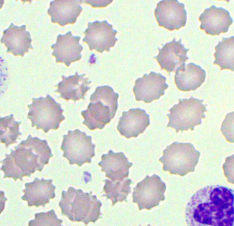 <p>Identify the RBC morphology </p>