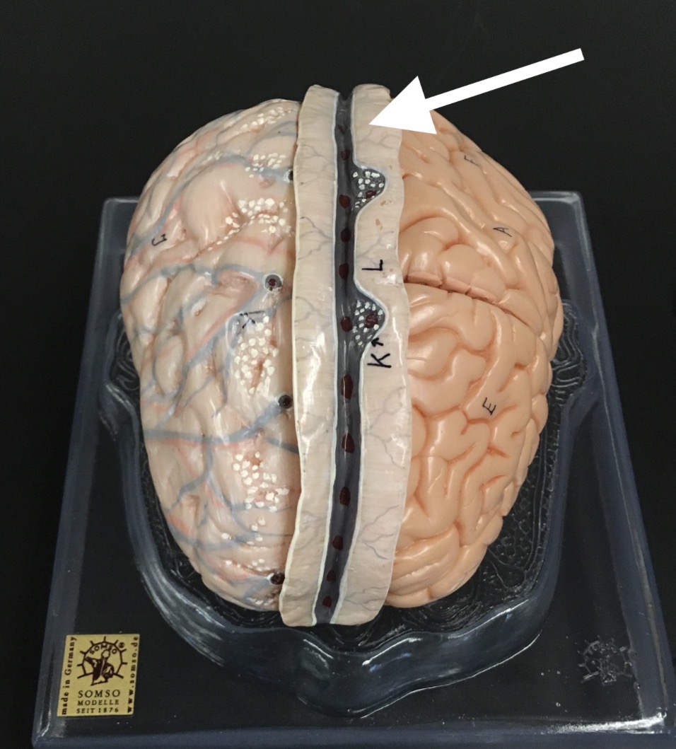 <p>What is the arrow pointing to?</p>