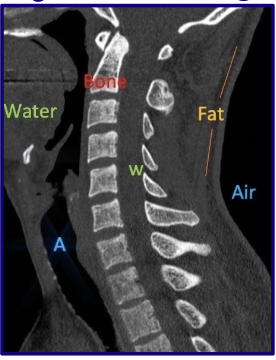 <p>Bone → White</p><ul><li><p><strong>white bones</strong></p></li></ul><p></p>