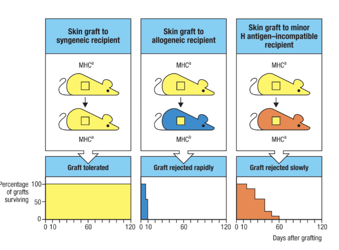 <ul><li><p>no perfect matching unless identical twins</p><ul><li><p>you ned immunosuppresion is essentail for everyone else</p></li></ul></li></ul><p>Minor histocompatability antigens: antigens that are different between recipeint and donor are not HLA</p><ul><li><p><span style="background-color: transparent; font-family: "Open Sans", sans-serif;">Y chromosome genes transplanted into an XX recipient are foreign</span></p></li><li><p><span style="background-color: transparent; font-family: "Open Sans", sans-serif;">Mostly autosomal &amp; mostly unknown</span></p></li><li><p><span style="background-color: transparent; font-family: "Open Sans", sans-serif;">Reject more slowly than HLA mismatches</span></p></li></ul><p></p><p></p><p></p>