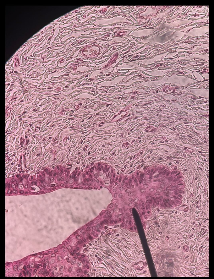 <p>ID tissue</p>