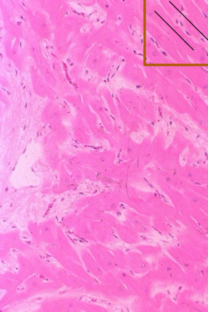 <p>Identify the condition?</p>
