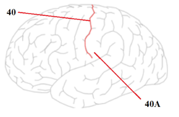 <p>What is affected at the location of 40A</p>