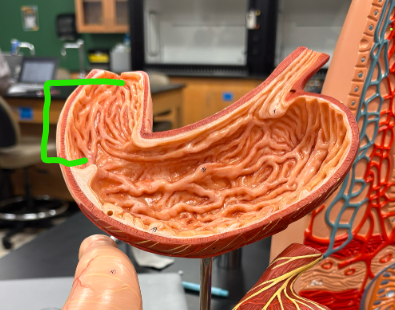 <p>What is the arrow pointing at?</p>