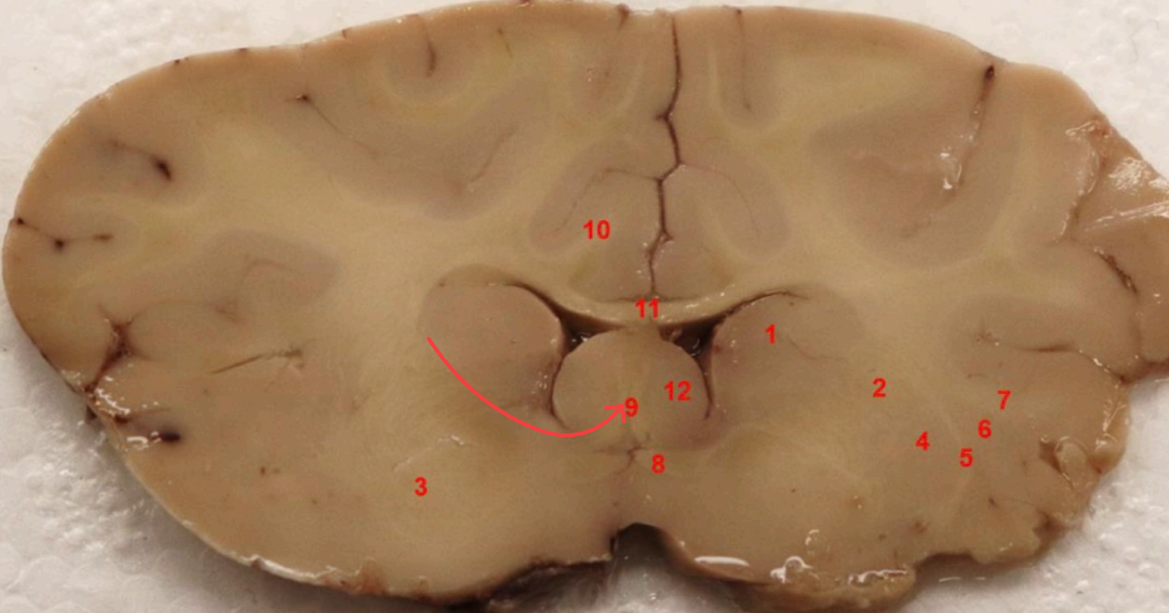 <p>what tract is this </p>