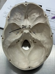 <p>What bone is this?</p>
