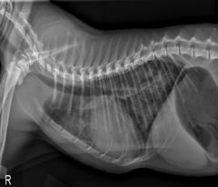 <p>Patchy interstitial to alveolar</p>