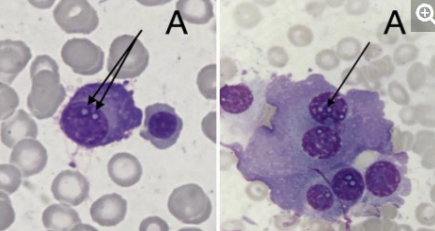 <p>what are dutcher bodies?</p>