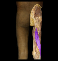 <p>Tibial Portion of Sciatic N</p>