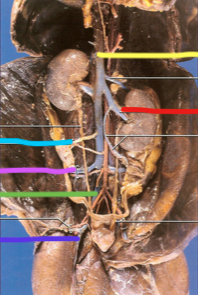 <p>What is the yellow line pointing to?</p>