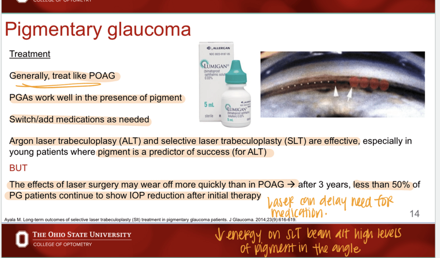 <p>What is the treatment of PG?</p>