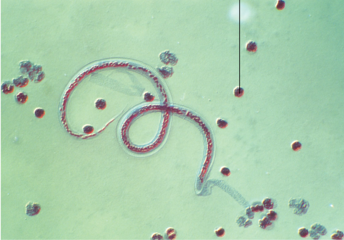 <p>What is this organism and what is the arrow pointing to?</p>