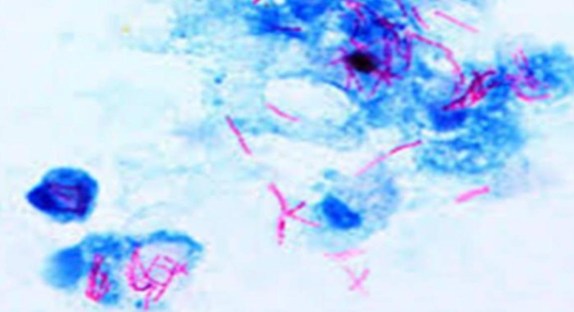 <p>Specimen (microscopically slide):</p><p>• Name of organism:</p><p>• Stain:</p><p>• Sample from: culture or pus or in tissue</p><p>• Morphology</p>