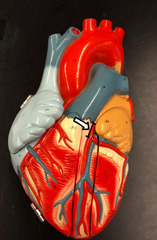 <p>the "straight" part that is next to the pulmonary artery</p>