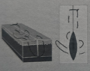<p>continuous horizontal mattress </p>