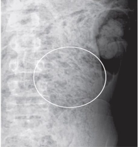 <p>Describe the radiograph</p>