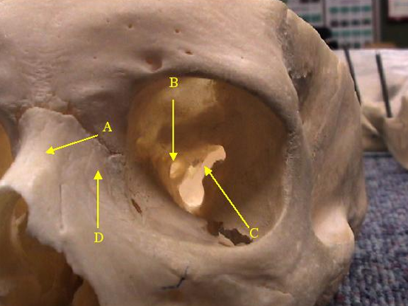 <p>B</p>