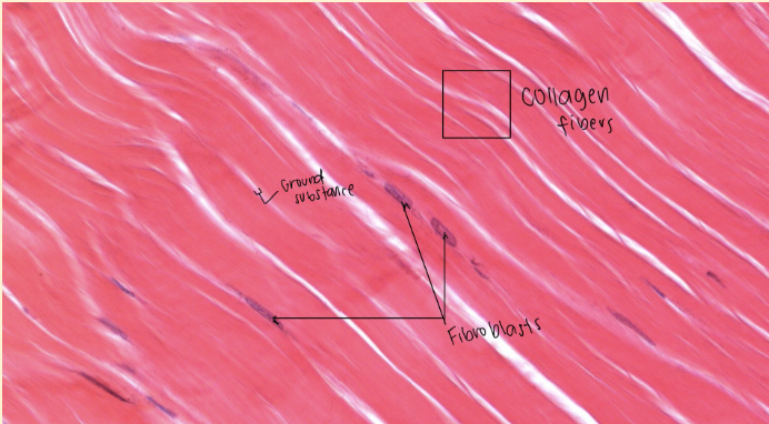 <p><span style="background-color: transparent;"><strong>DENSE REGULAR CONNECTIVE TISSUE</strong></span></p>