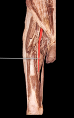 <p>Passes through adductor magnus. Extension of the external iliac artery. Supplies anterior structures of the thigh.</p>