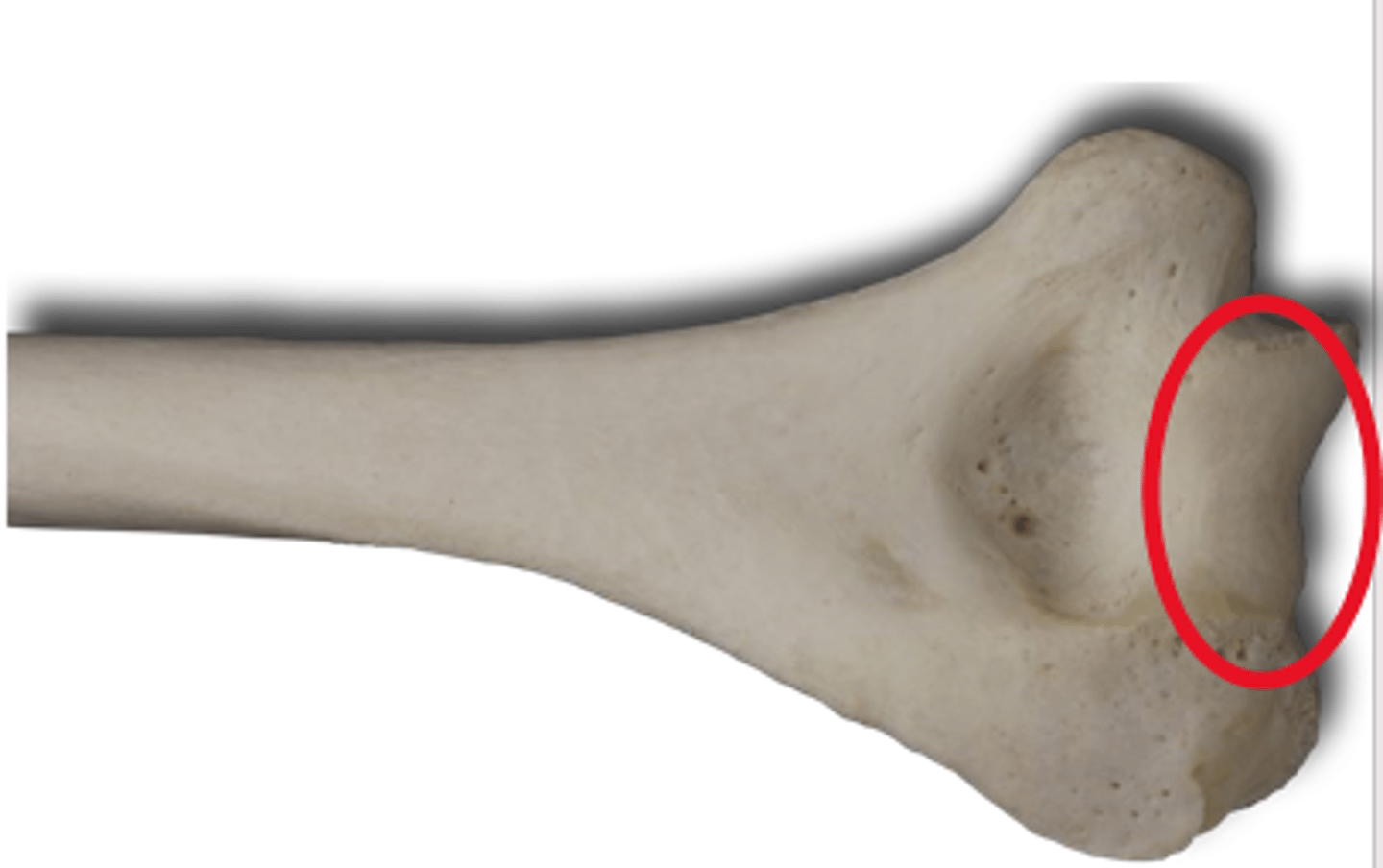 <p>Posterior Humerus</p>