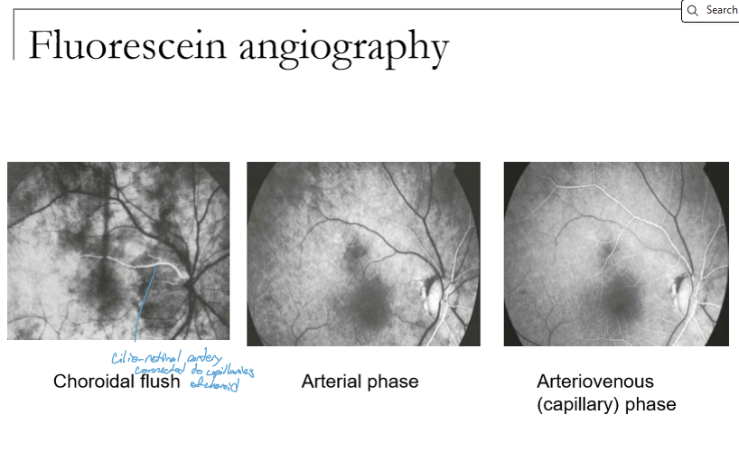 <p>Retinal circulation follows these phases:</p><ol><li><p>Arterial phase</p></li><li><p>Arteriovenous (capillary) phase</p></li><li><p>Early venous phase</p></li><li><p>Mid‑venous phase</p></li><li><p>Late venous phase</p></li><li><p>Late fade of both retinal and choroidal fluorescence</p></li></ol><p></p>