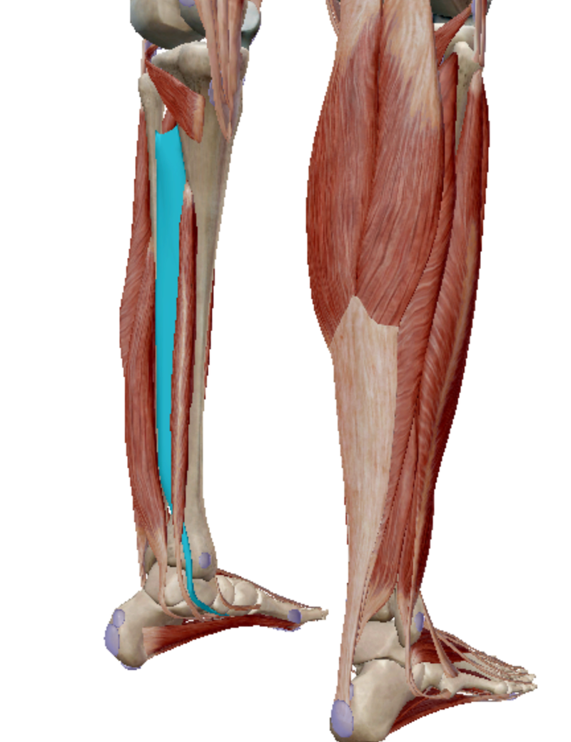 <p>Identify the highlighted muscle. </p>