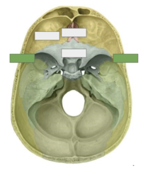 <p>This is</p>