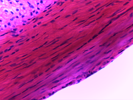 term image