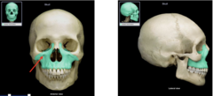 <p>What is the highlighted bone?</p>