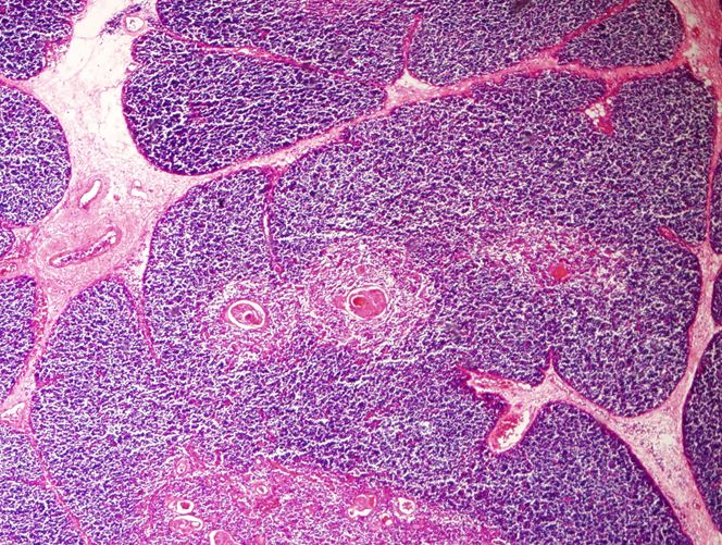 <p>Tiêu bản gì ?</p>