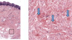 <p>Identify the eosinophilic structures at the arrows.</p>