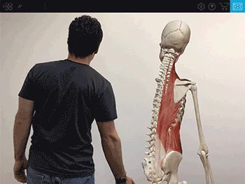 <p>Lateral flexion</p>