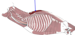 <p>What muscle, part of the transversospinalis system, is shown?</p>