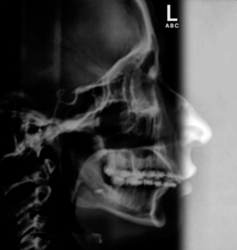 <p>what is off focus radiation</p>