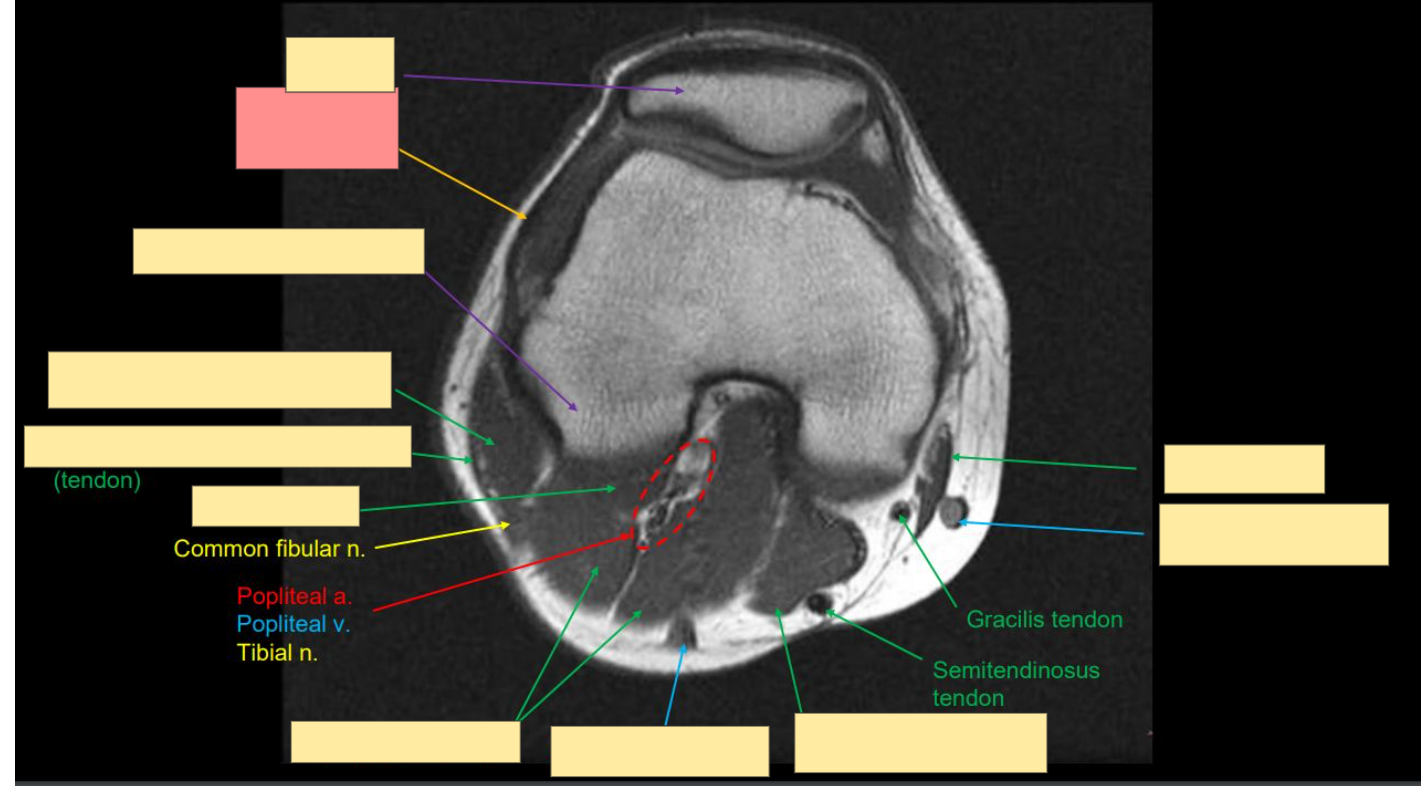 <p>Identify the structure </p>