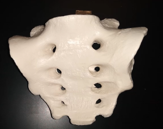 <p>What is this this surface?</p>