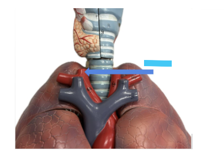 <p>What is the blue arrow?</p>
