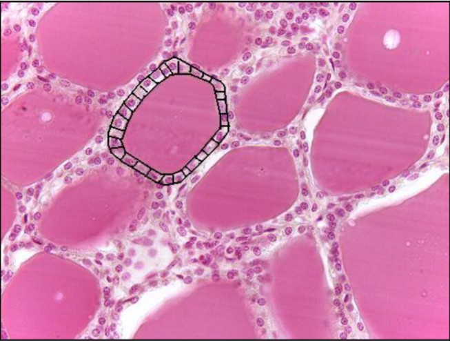 <p>Simple Cuboidal epithelium</p>