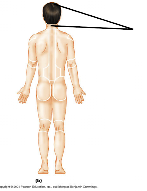 <p>Cephalic (P)</p>