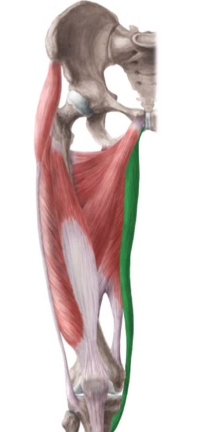 <p>Name of this muscle?</p>