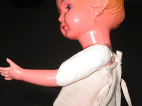 <p><span>fracture of the shaft of the humerus with callus formation</span></p>