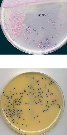 <p>pink; Denim; presumptive; definitive; screening; accidental</p>
