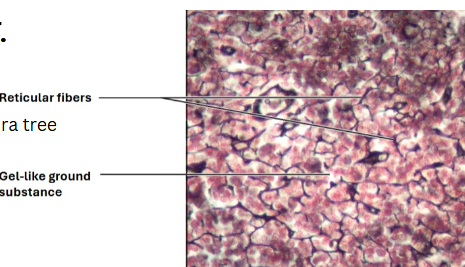 <p>Structures:</p><p>Reticular fibers (branch-like stems of sakura tree)</p><p></p><p>Location:</p><p>lymph nodes</p><p>bone marrow</p><p>spleen</p>