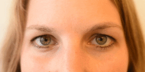 <p>Brow Lowerer</p>