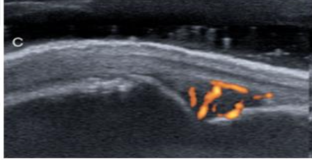 <p>Grade this doppler</p>