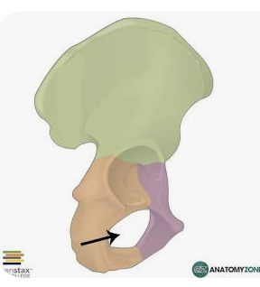 <p>Name this part of the pelvis</p>