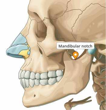 <p>A chuck looks like it was taken out of the bone, indentation in the end of the bone </p>