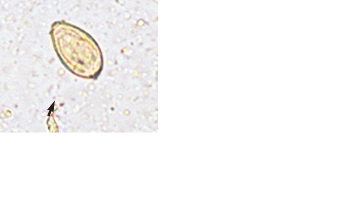 <p>Name the fluke or flatworm</p>